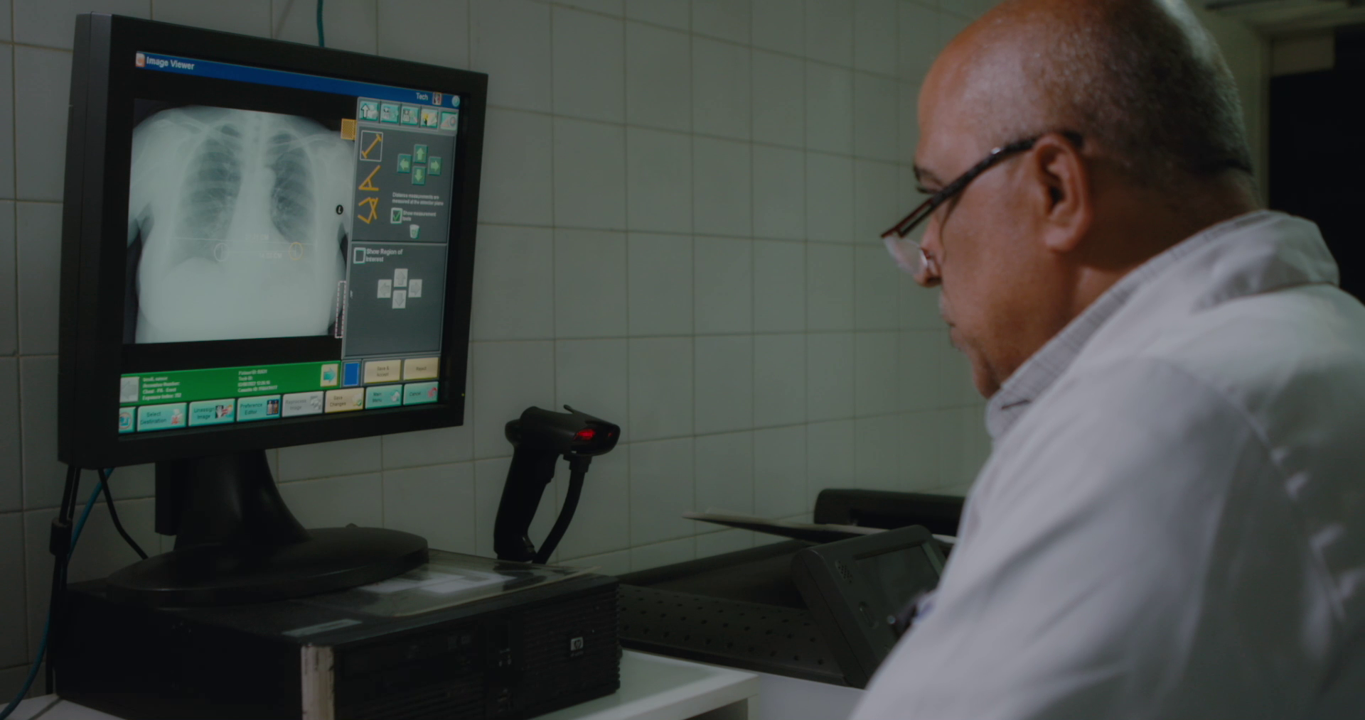 X ray diagnostics